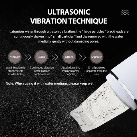 Ultrasonic Skin Scrubber Peeling Blackhead Remover Deep Face Cleaning Ultrasonic Ion Acne Pore Cleaner Facial Shovel Cleanser